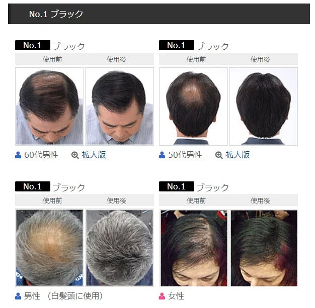 日本 Super Million Hair 天然纖維髮絲